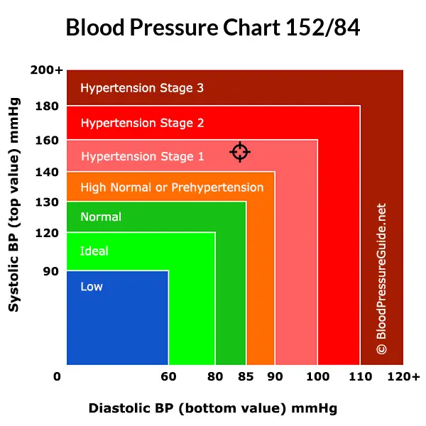 blood-pressure-152-over-84-what-you-need-to-know