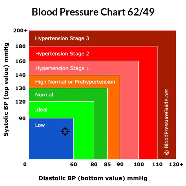 Blood pressure 62 over 49 on the blood pressure chart