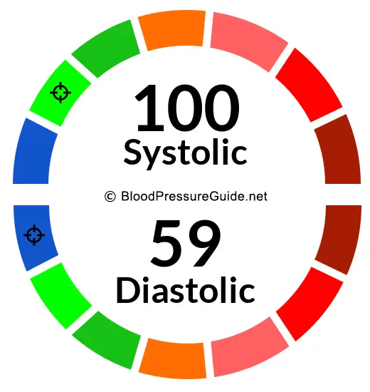 Blood Pressure 100/59 on the blood pressure scale