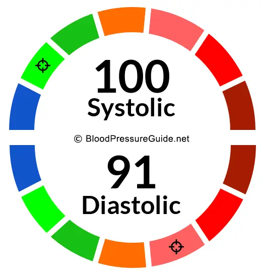 blood-pressure-100-over-91-what-you-need-to-know