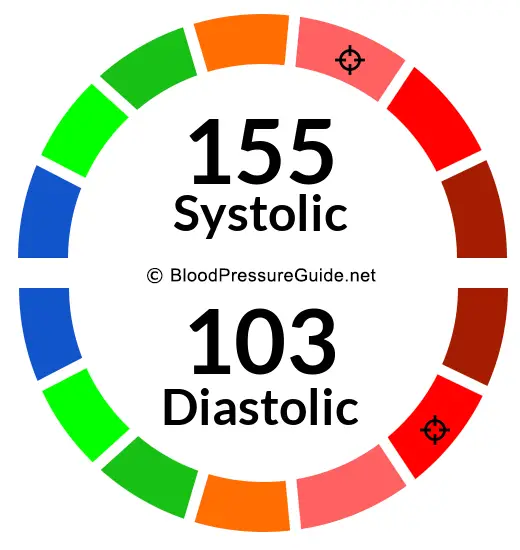 blood-pressure-155-over-103-what-you-need-to-know