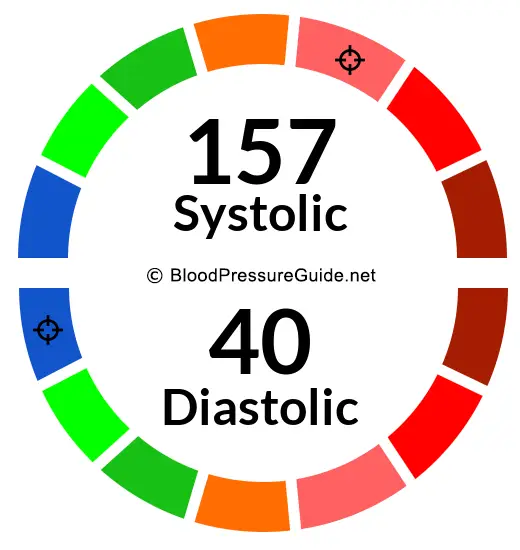 blood-pressure-157-over-40-what-you-need-to-know