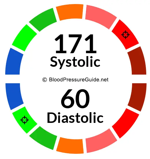 blood-pressure-171-over-60-what-you-need-to-know