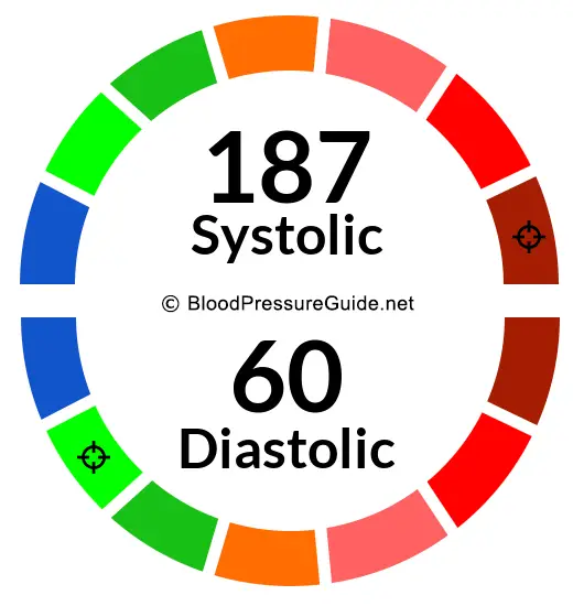 blood-pressure-187-over-60-what-you-need-to-know