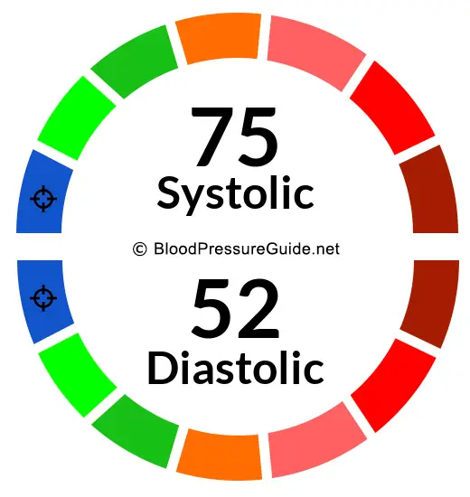 Blood Pressure 75/52 on the blood pressure scale