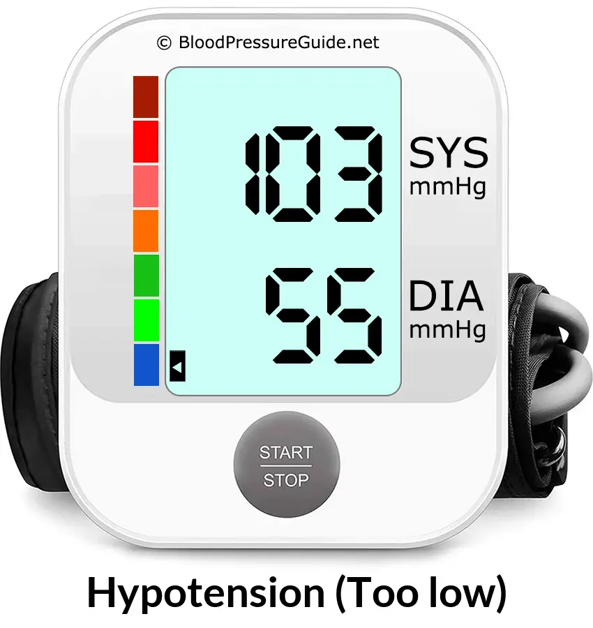 Blood Pressure 103 over 55 on the blood pressure monitor