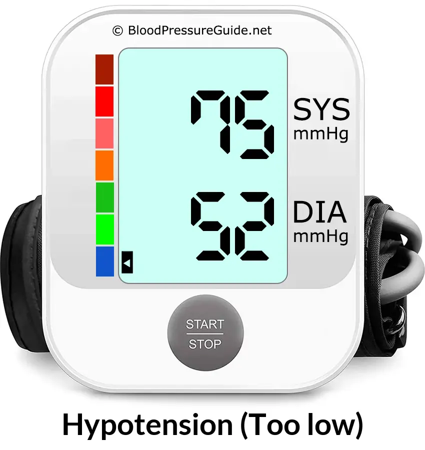 Blood Pressure 75 over 52 on the blood pressure monitor